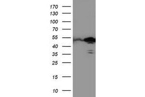Western Blotting (WB) image for anti-T-Cell Acute Lymphocytic Leukemia 1 (TAL1) antibody (ABIN1501292) (TAL1 anticorps)
