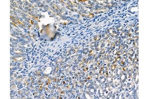 ABIN6260504 and ABIN6279263 at 1/100 staining rat stomach tissue by IHC-P. (CATSPER1 anticorps  (N-Term))