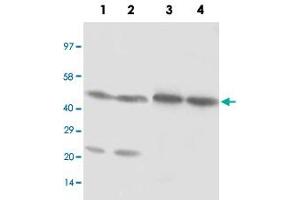 Western blot analysis of cell and tissue lysates with NR1H3 polyclonal antibody . (NR1H3 anticorps  (C-Term))