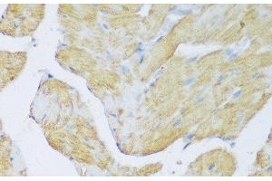 Immunohistochemistry of paraffin-embedded Rat heart using DENR Polyclonal Antibody at dilution of 1:150 (40x lens). (Density Regulated Protein anticorps)