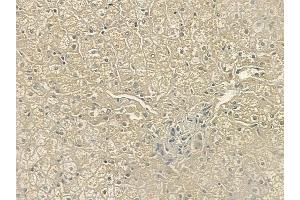 ABIN6259270 and ABIN6274431 at 1/100 staining human normal liver tissue by IHC-P.