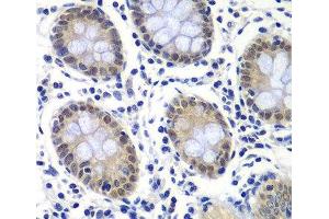 Immunohistochemistry of paraffin-embedded Human colon using GTF2F2 Polyclonal Antibody at dilution of 1:200 (40x lens). (GTF2F2 anticorps)