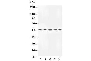 Western blot testing of MKK4 antibody and Lane 1:  rat skeletal muscle (MAP2K4 anticorps  (C-Term))