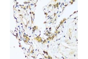 Immunohistochemistry of paraffin-embedded Human lung using BAG3 Polyclonal Antibody at dilution of 1:100 (40x lens). (BAG3 anticorps)