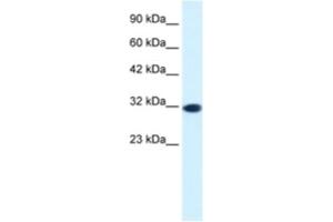 Western Blotting (WB) image for anti-Empty Spiracles Homeobox 2 (EMX2) antibody (ABIN2460259) (EMX2 anticorps)