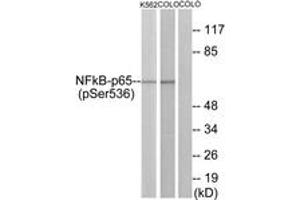 Western blot analysis of extracts from K562 cells and COLO cells, using NF-kappaB p65 (Phospho-Ser536) Antibody. (NF-kB p65 anticorps  (pSer536))