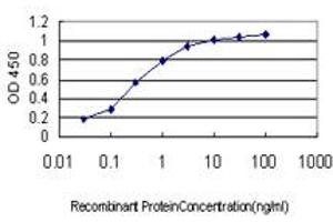Detection limit for recombinant GST tagged SYMPK is approximately 0. (Symplekin anticorps  (AA 1-533))