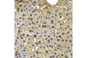 Immunohistochemistry of paraffin-embedded mouse liver using SORT1 antibody at dilution of 1:100 (40x lens). (Sortilin 1 anticorps)