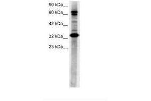 Image no. 3 for anti-TGF-beta Activated Kinase 1/MAP3K7 Binding Protein 2 (TAB2) (N-Term) antibody (ABIN6735781) (TAB2 anticorps  (N-Term))