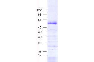 Validation with Western Blot (ZNF35 Protein (His tag))