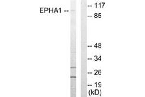 Western blot analysis of extracts from COLO205 cells, using EPHA1 Antibody.