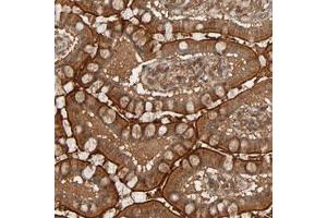Immunohistochemical staining (Formalin-fixed paraffin-embedded sections) of human small intestine with RPS6KA6 polyclonal antibody  shows strong cytoplasmic and membranous positivity in glandular cells. (RPS6KA6 anticorps)