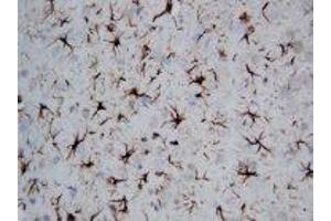 Image no. 1 for anti-Glial Fibrillary Acidic Protein (GFAP) (C-Term) antibody (ABIN1493067) (GFAP anticorps  (C-Term))