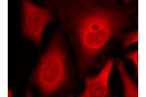 Immunofluorescence staining of methanol-fixed HeLa cells using EIF2S1 (phospho S49) polyclonal antibody (Cat # PAB25902, red). (EIF2S1 anticorps  (pSer49))
