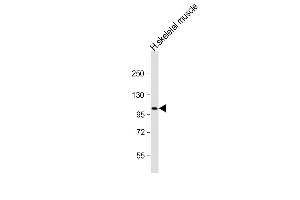 Anti-ATP1A2 Antibody (Center) at 1:2000 dilution + human skeletal muscle lysate Lysates/proteins at 20 μg per lane.