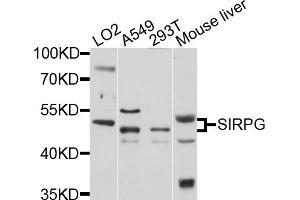 Western blot analysis of extracts of various cell lines, using SIRPG antibody (ABIN1876133) at 1:1000 dilution. (SIRPG anticorps)