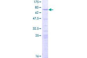 Image no. 1 for Ly1 Antibody Reactive (LYAR) (AA 1-379) protein (GST tag) (ABIN1309919)