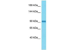 Host: Rabbit Target Name: FSIP2 Sample Type: Placenta lysates Antibody Dilution: 1. (FSIP2 anticorps  (C-Term))