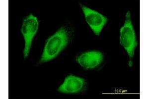 Immunofluorescence of purified MaxPab antibody to HARS on HeLa cell. (HARS1/Jo-1 anticorps  (AA 1-509))