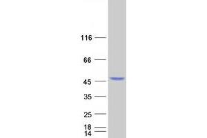 Validation with Western Blot