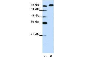 Human Jurkat; WB Suggested Anti-AKAP8L Antibody Titration: 1. (AKAP8L anticorps  (C-Term))