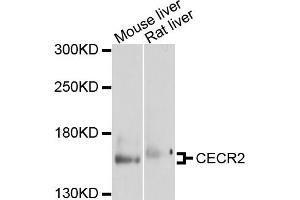 Western blot analysis of extracts of various cell lines, using CECR2 antibody (ABIN6003841) at 1/1000 dilution. (CECR2 anticorps)