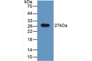 Detection of Recombinant GAS, Rat using Polyclonal Antibody to N-Acetylgalactosamine-6-Sulfatase (GALNS) (GALNS anticorps  (AA 172-381))