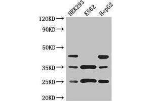 Western Blot Positive WB detected in: HEK293 whole cell lysate, K562 whole cell lysate, HepG2 whole cell lysate All lanes: PCTP antibody at 3 μg/mL Secondary Goat polyclonal to rabbit IgG at 1/50000 dilution Predicted band size: 25, 17 kDa Observed band size: 25, 35, 45 kDa (PCTP anticorps  (AA 1-214))