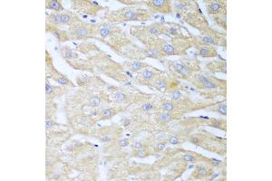 Immunohistochemistry of paraffin-embedded human liver using NUDT15 antibody. (NUDT15 anticorps)