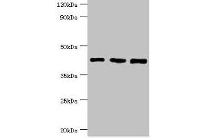 Western blot All lanes: SWI/SNF-related matrix-associated actin-dependent regulator of chromatin subfamily B member 1 antibody at 8 μg/mL Lane 1: Hela whole cell lysate Lane 2: 293T whole cell lysate Lane 3: Mouse stomach tissue Secondary Goat polyclonal to rabbit IgG at 1/10000 dilution Predicted band size: 45, 44 kDa Observed band size: 45 kDa