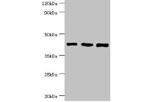 Western blot All lanes: SWI/SNF-related matrix-associated actin-dependent regulator of chromatin subfamily B member 1 antibody at 8 μg/mL Lane 1: Hela whole cell lysate Lane 2: 293T whole cell lysate Lane 3: Mouse stomach tissue Secondary Goat polyclonal to rabbit IgG at 1/10000 dilution Predicted band size: 45, 44 kDa Observed band size: 45 kDa (SMARCB1 anticorps  (AA 86-385))