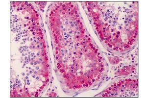 Human Testis: Formalin-Fixed, Paraffin-Embedded (FFPE) (NANOS3 anticorps  (C-Term))