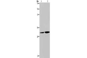 Gel: 8 % SDS-PAGE, Lysate: 40 μg, Lane 1-2: HT29 cells, human placenta tissue, Primary antibody: ABIN7129237(DNASE1L3 Antibody) at dilution 1/450, Secondary antibody: Goat anti rabbit IgG at 1/8000 dilution, Exposure time: 30 seconds (DNASE1L3 anticorps)
