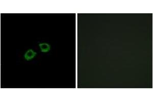 Immunofluorescence analysis of A549 cells, using ARFGEF2 Antibody. (ARFGEF2 anticorps  (AA 1491-1540))