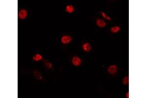 ABIN6266847 staining HepG2 by IF/ICC. (HNF4 alpha/gamma anticorps)