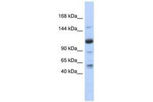 Image no. 1 for anti-U2-Associated SR140 Protein (SR140) (AA 71-120) antibody (ABIN6740719) (SR140 anticorps  (AA 71-120))