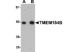 Western Blotting (WB) image for anti-Transmembrane Protein 184B (TMEM184B) (C-Term) antibody (ABIN1030751) (TMEM184B anticorps  (C-Term))