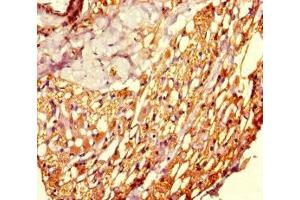 Immunohistochemistry of paraffin-embedded human thyroid tissue using ABIN7160766 at dilution of 1:100 (SETD8 anticorps  (AA 136-258))
