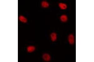 ABIN6267046 staining HepG2 by IF/ICC. (H1FOO anticorps  (Internal Region))
