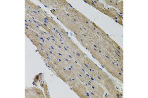 Immunohistochemistry of paraffin-embedded rat heart using ALDH9A1 antibody (ABIN5995392) (40x lens). (ALDH9A1 anticorps)