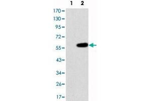 Western blot analysis using MAP3K2 monoclonal antibody, clone 4B4  against HEK293 (1) and MAP3K2-hIgGFc transfected HEK293 (2) cell lysate.