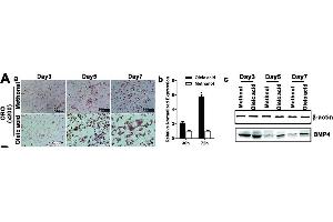BMP4 expression is elevated during Oleic acid-induced triglyceride/lipid accumulation in hepatocytes and in a mouse model of NAFLD. (BMP4 anticorps)