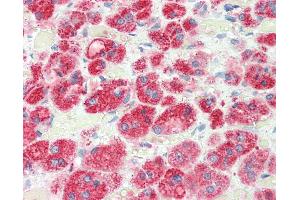 Anti-RGS5 antibody IHC staining of human adrenal.