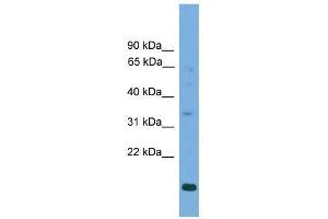 Western Blot showing SLC25A44 antibody used at a concentration of 1-2 ug/ml to detect its target protein. (SLC25A44 anticorps  (Middle Region))