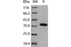 Western Blotting (WB) image for Protein tyrosine Phosphatase, Non-Receptor Type 1 (PTPN1) (Active) protein (His tag) (ABIN7317110)
