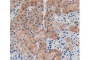 Used in DAB staining on fromalin fixed paraffin- embedded kidney tissue (EPB41 anticorps  (AA 211-498))