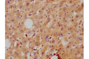 IHC image of ABIN7127342 diluted at 1:87. (Recombinant APOA2 anticorps)