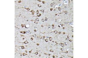 Immunohistochemistry of paraffin-embedded rat brain using Phospho-KRAS-S89 Rabbit pAb (ABIN7267530) at dilution of 1:100 (40x lens).