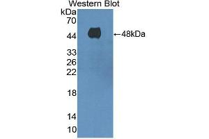 Figure. (ADCY8 anticorps  (AA 234-371))