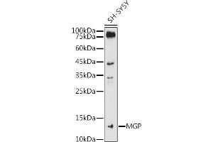 Western blot analysis of extracts of SH-SY5Y cells, using MGP antibody (ABIN6128268, ABIN6143825, ABIN6143826 and ABIN6221090) at 1:1000 dilution. (MGP anticorps  (AA 20-103))